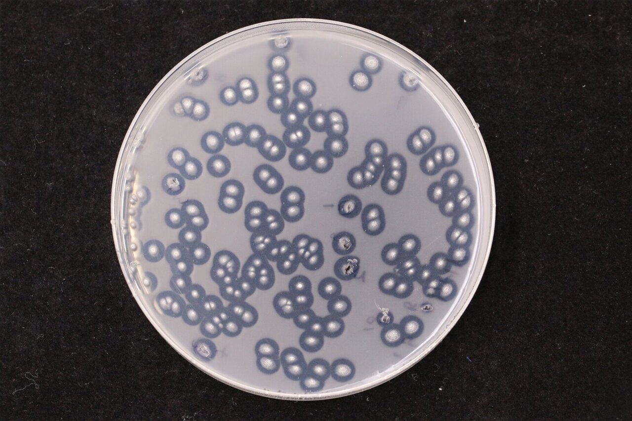 Fungi can degrade plastics and other pollutants, offering potential solutions for waste management and climate change.
aayushii.com