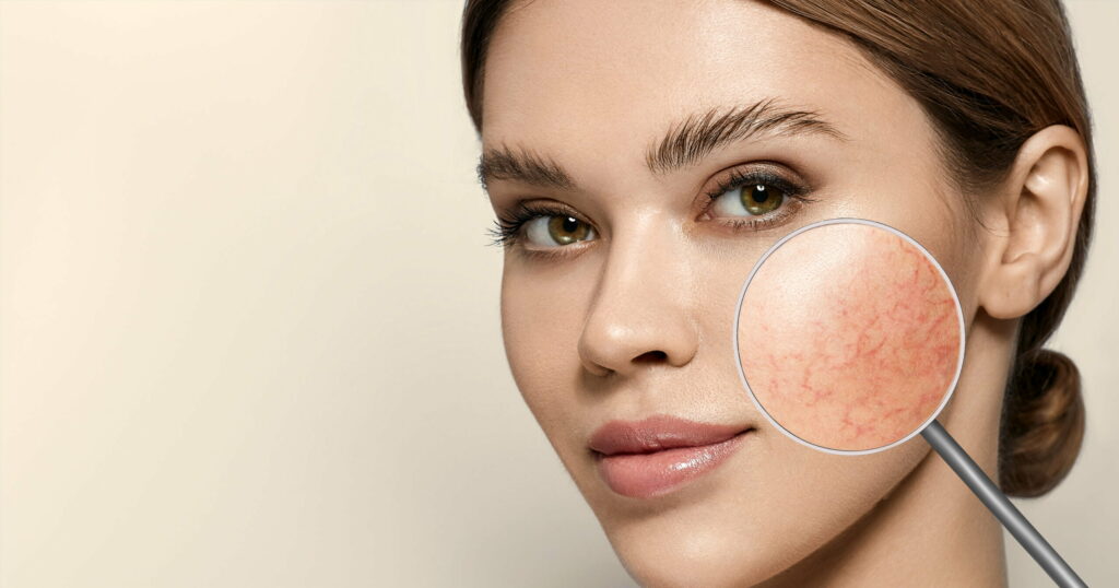 Causes of Sensitive Skin