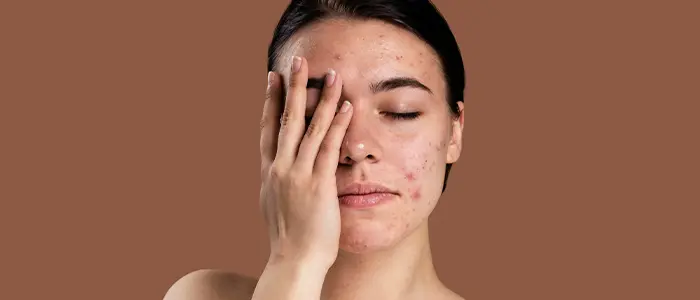 The Pitfalls of Natural Skincare

aayushii.com