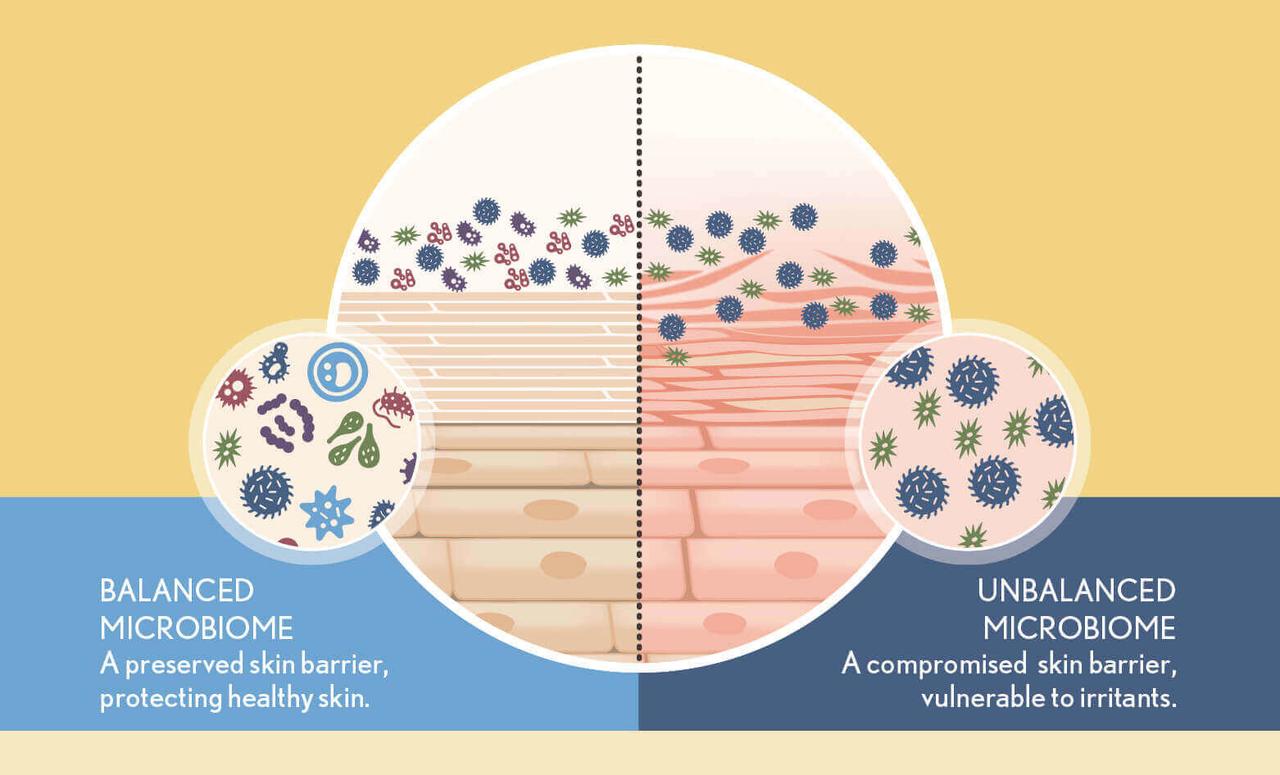 Hydration and the Skin Microbiome