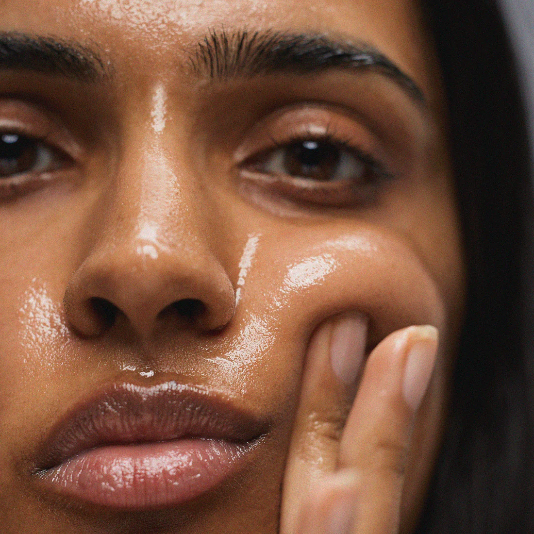 What Causes Oily Skin?