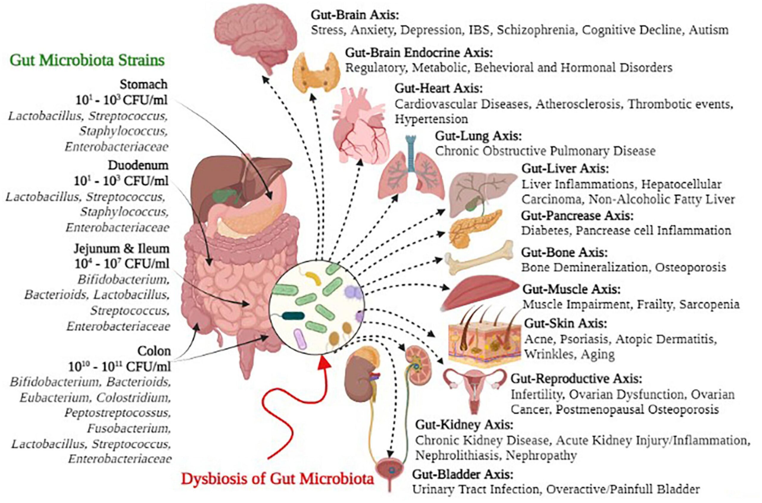 Dysbiosis and its Consequences

aayushii.com