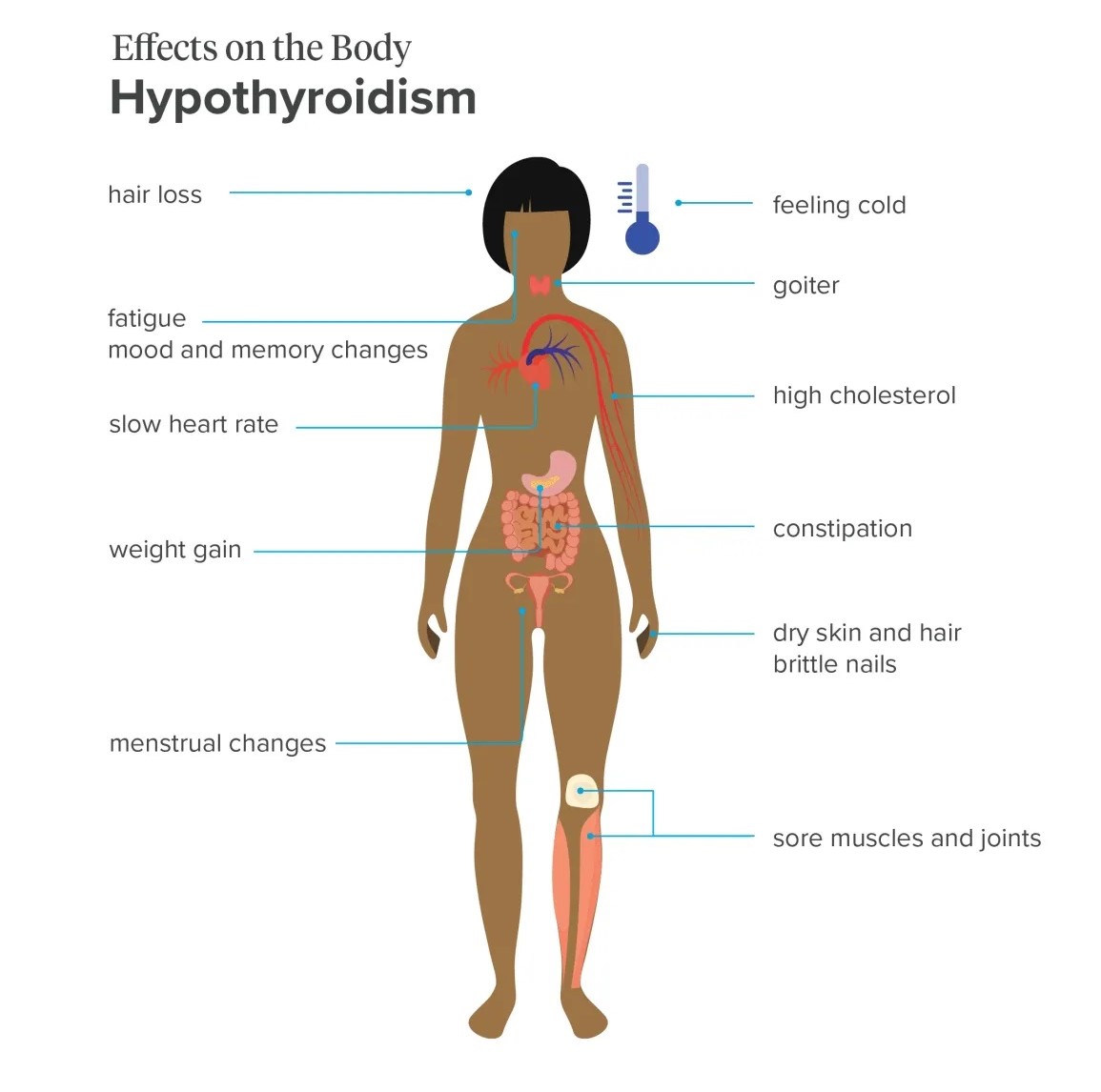 Hypothyroidism (Underactive Thyroid)